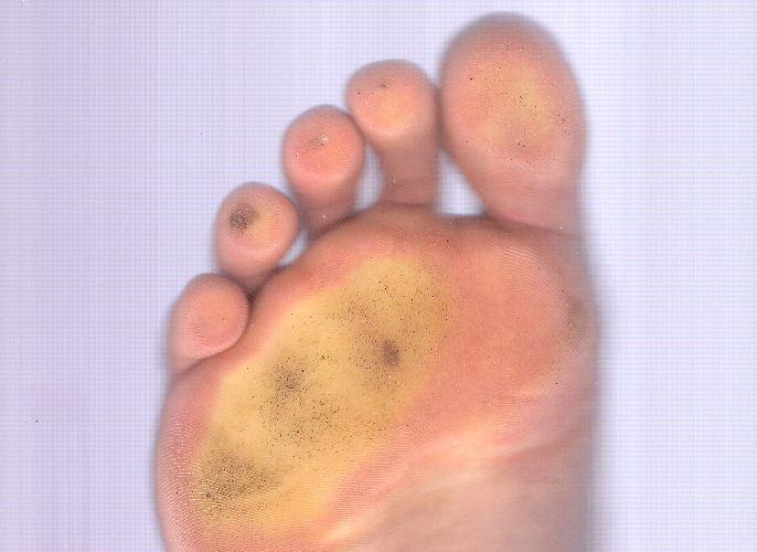 Foot Scan